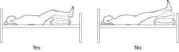 Acute Inflam2