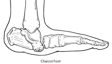 Figure, Ankle joint Image courtesy Dr Chaigasame] - StatPearls