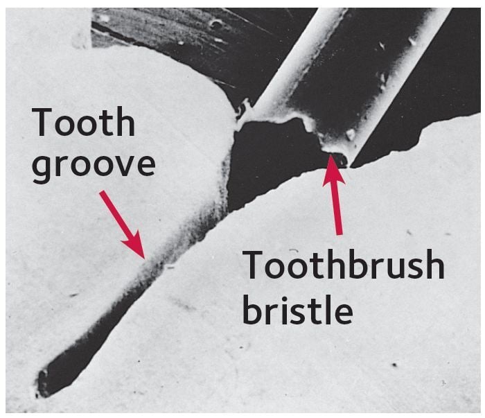 Molar magnified