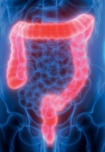 Why is bowel prep important?