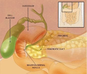 chronic pancreatitis ercp