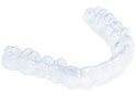 ClearCorrect aligner