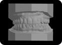 3D model of teeth