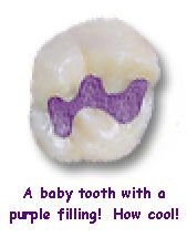 A baby tooth with a purple filling