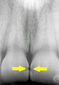 How to read an x-ray