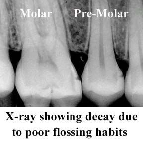 How to read an x-ray