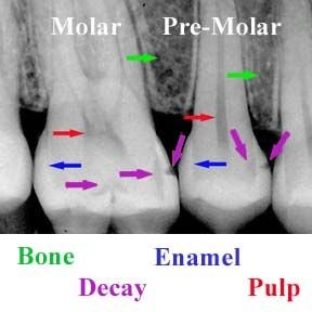 How to read an x-ray