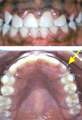 Orthodontics After