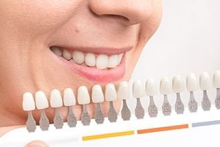 Bleaching of the teeth at dentist clinic. UV Whitening teeth. Repair  cracked or fractured teeth and remove teeth. Stock Photo