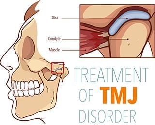TMJ Treatment Cary NC