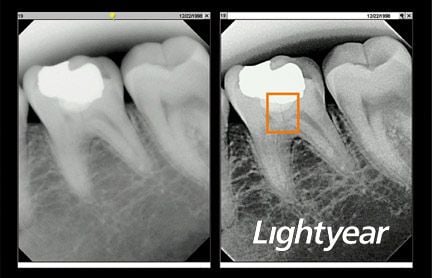 Lightyear x-ray