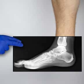Bensalem Podiatrist - The Foot & Ankle Center, Inc - Foot Doctor Bensalem,  PA