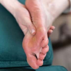 Preventing Corns and Calluses: Foot Care Tips from Dr Foot Podiatry Clinic