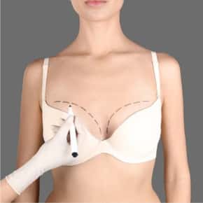 Breast Lift Procedures (Mastopexy) for Drooping Breasts - Dr. John
