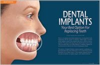 Dental Implants Worcester