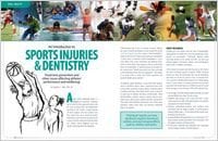 Sports Injuries - Emergency Dental Near Me Hartford, CT