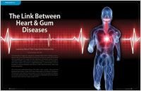 Link Between Heart and Gum Disease - Dear Doctor Magazine