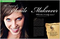Esthetic Dental Smile Makeover | Encino Esthetic Dentist