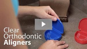 Canton OH Clear Orthodontic Aligners Video