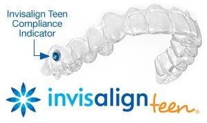 Invisalign teen | Dentist in Tustin, CA | Shirley Santos, DDS