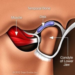 TMJ Joint pain Danville CA