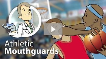 Athletic mouthguards video | Dentist in Turlock, CA | Accurate Family Dental