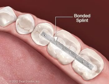 Nu Dentistry  Tooth Contouring: A Quick and Painless Procedure