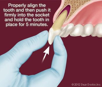 Emergency Dentistry | Dentist in Turlock, CA | Accurate Family Dental