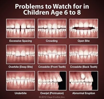 Scarborough Orthodontic Problems.