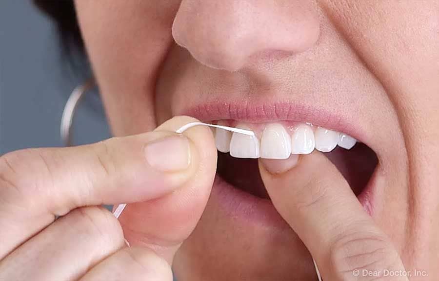 Cómo usar hilo dental