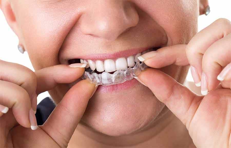 Cómo Usar el Hilo Dental  Advanced Smiles Dental, P.A.