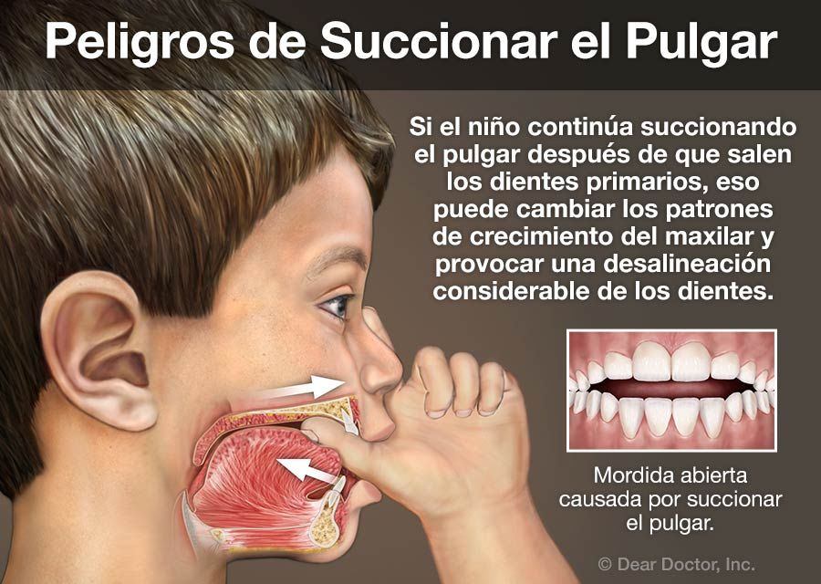 La lengua no muerde 4–¿Qué significa el significado? – Necesitas otra lengua