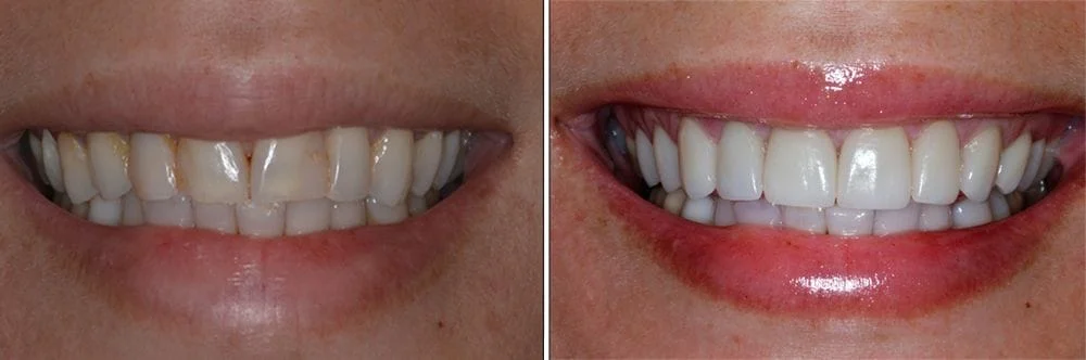 Before and After Sunshine Dentistry