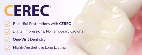 Fort Myers CEREC Same Day Crowns