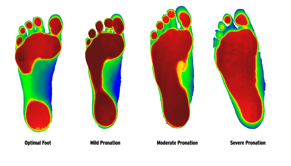 Cusdtom Foot ORthotics
