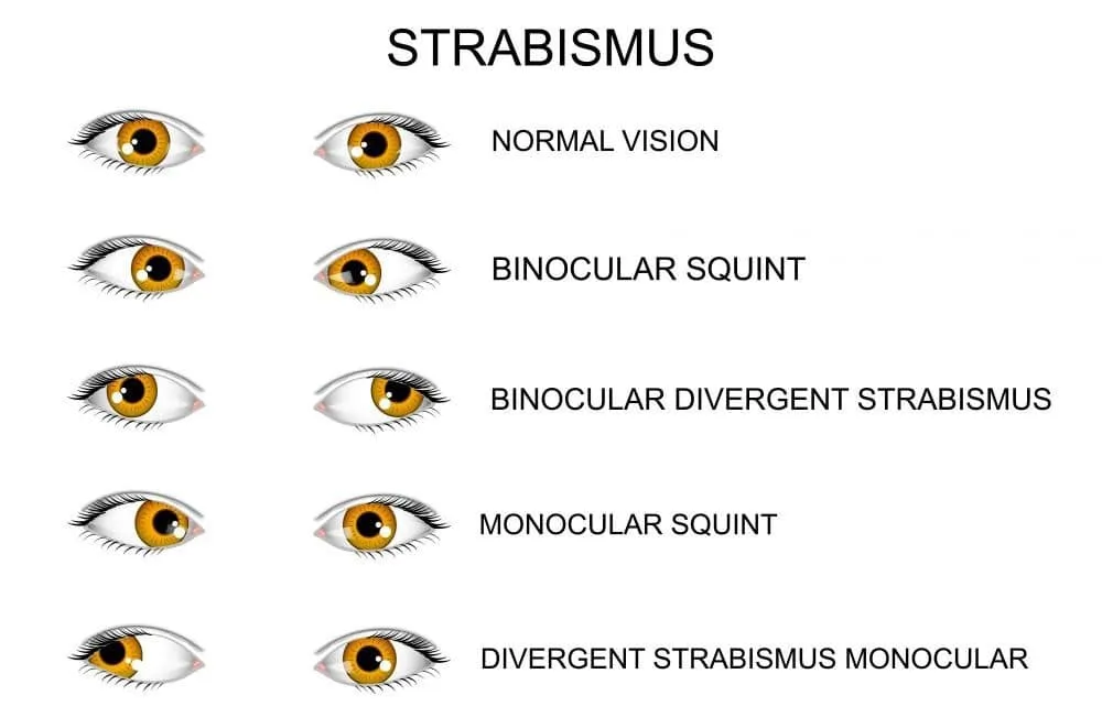 Different types of vision problems