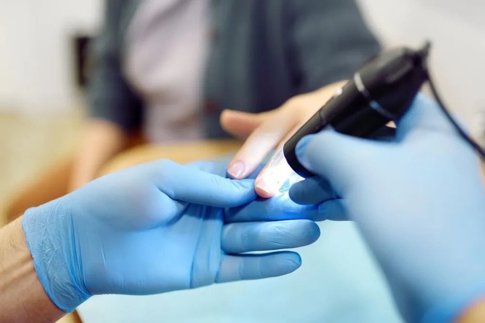 Patient having their nails treated