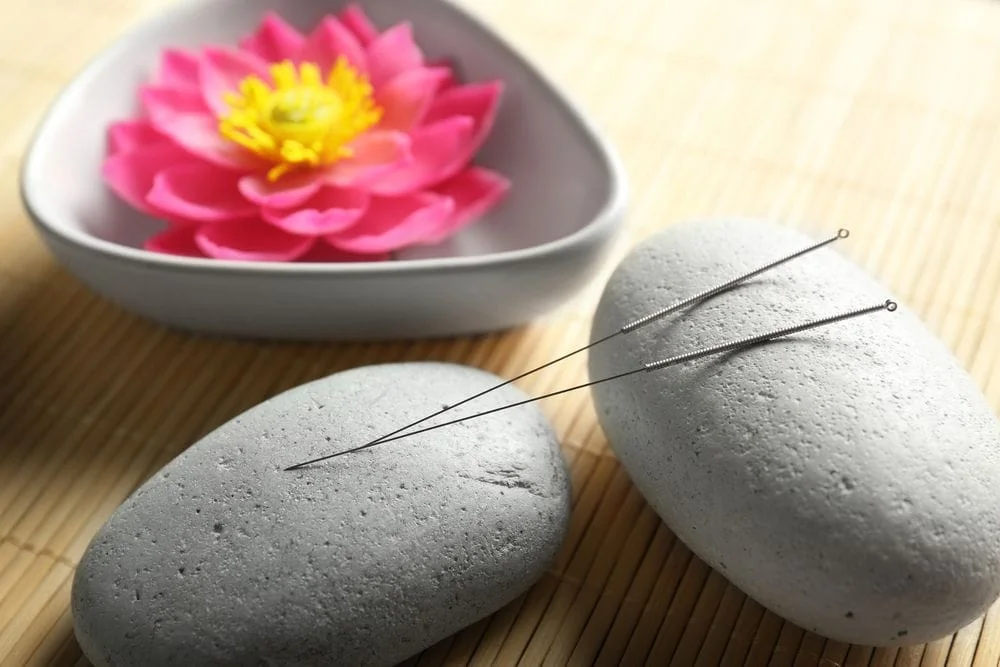 Acupuncture needles on a rock