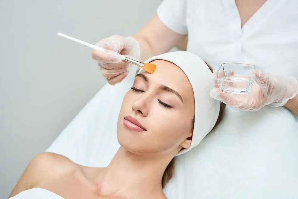 What is a Chemical Peel?
