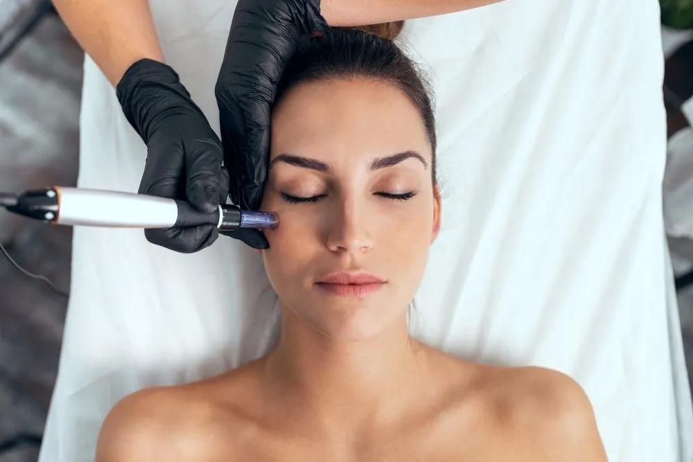 How does Microneedling Work?