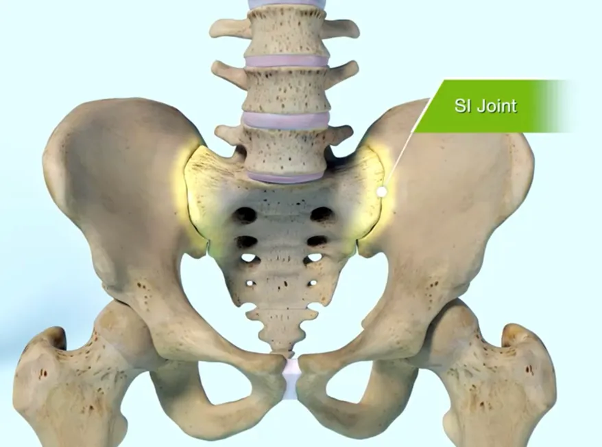 Sacroiliac Joint
