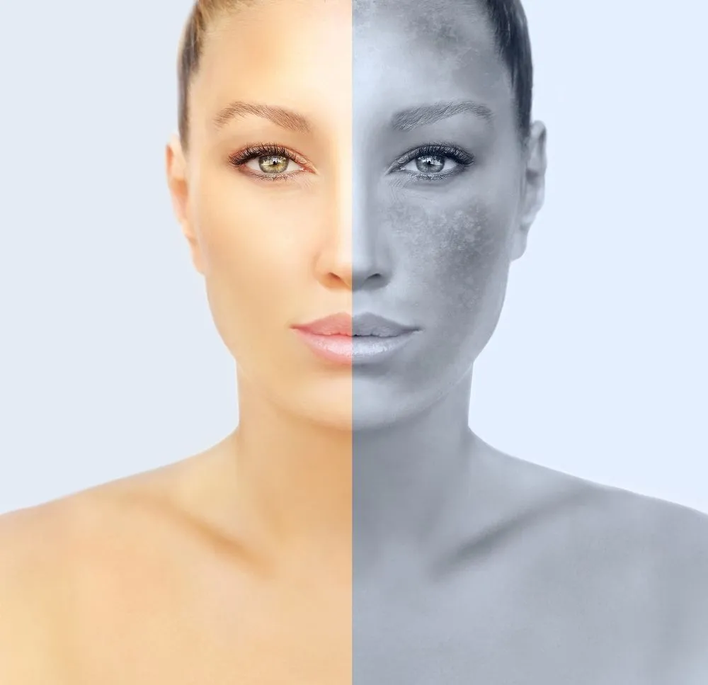 Are Chemical Peels safe?