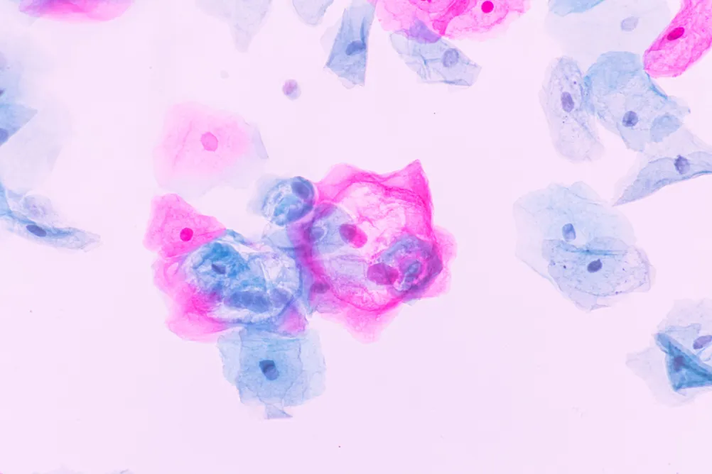 Cytology