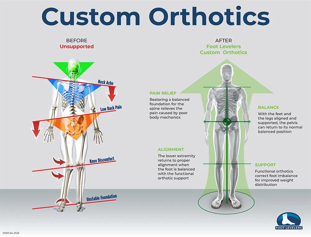 Orthotics
