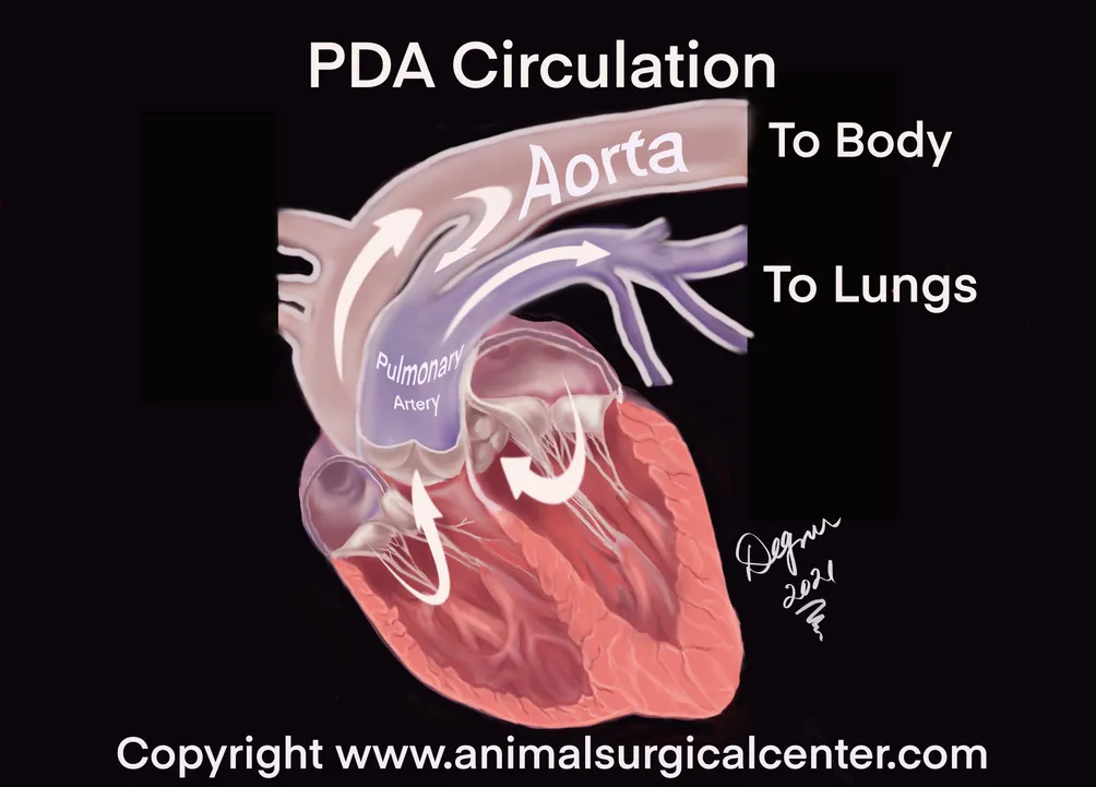 PDA circulation 