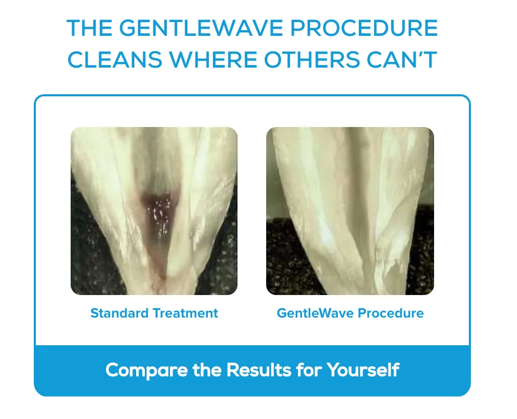 Gentlewave Clean