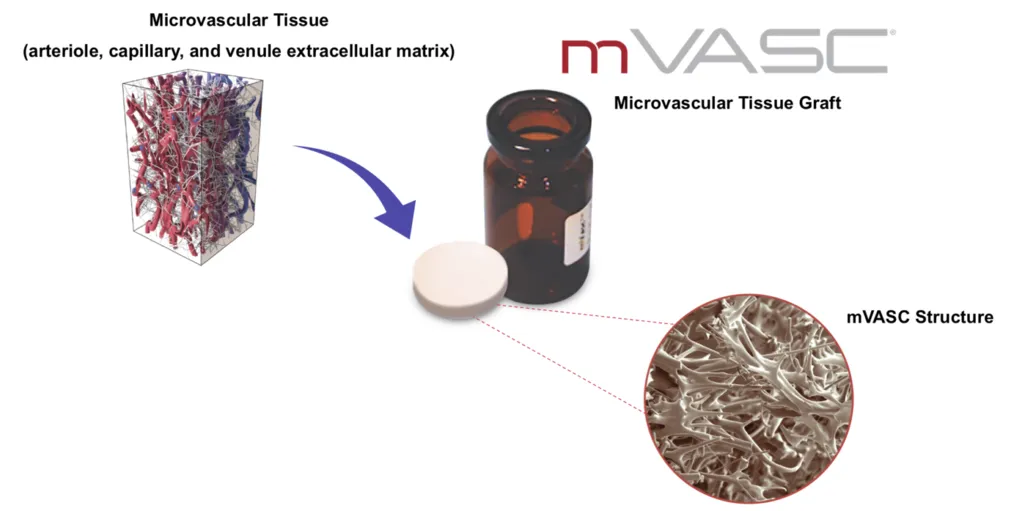 mVASC for joint pain