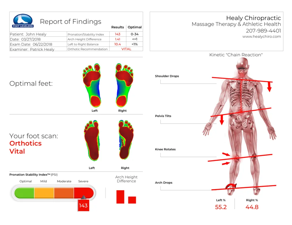 Uneven foot scan flat feet