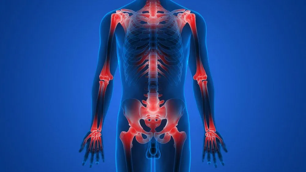 joint pain illustration