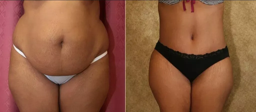 THE BEST 10 Body Contouring in BRICK, NJ - Yelp - Last Updated